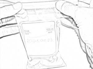 &ouml;t&ouml;dik l&eacute;p&eacute;s